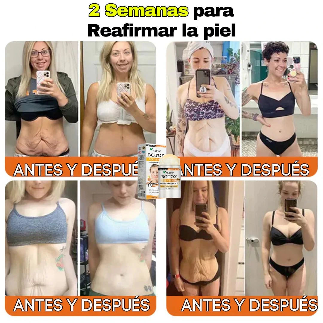 BARRA REAFIRMANTE+ ENVÍO GRATIS