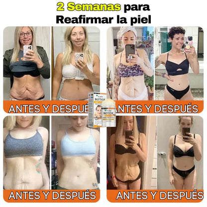 BARRA REAFIRMANTE+ ENVÍO GRATIS
